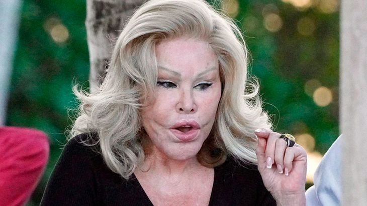 Quién Es Jocelyn Wildenstein La Gatúbela De Nueva York Que Pasó De Ser