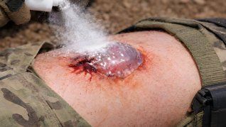 Un nuevo enfoque para emergencias apunta a actuar rápido cuando una herida no da margen y el tiempo se vuelve decisivo. Un nuevo enfoque para emergencias apunta a actuar rápido cuando una herida no da margen y el tiempo se vuelve decisivo.