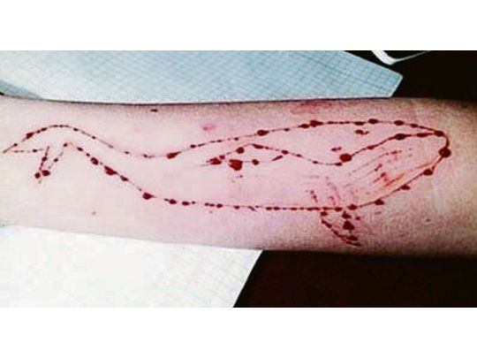 Pasos. El juego consta de 50 pasos, uno de ellos es cortarse la piel y dibujarse una ballena en un brazo. El último consiste en suicidarse.
