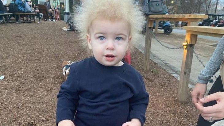 Niño sufre un extraño síndrome que hace imposible peinar su cabello 