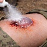 Un nuevo enfoque para emergencias apunta a actuar rápido cuando una herida no da margen y el tiempo se vuelve decisivo. Un nuevo enfoque para emergencias apunta a actuar rápido cuando una herida no da margen y el tiempo se vuelve decisivo.