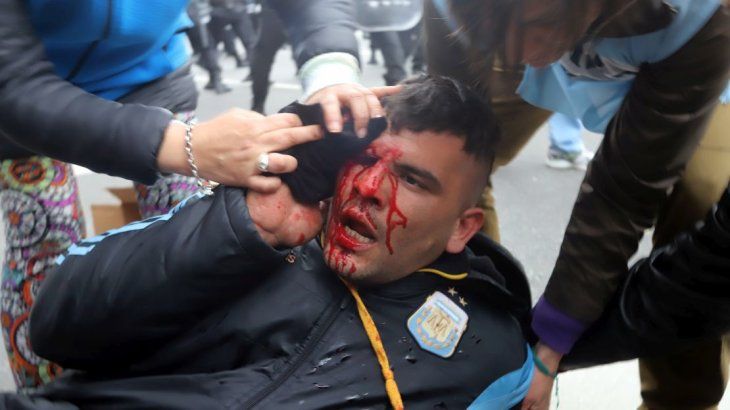 Uno de los agredidos durante la represión al acampe este miércoles.