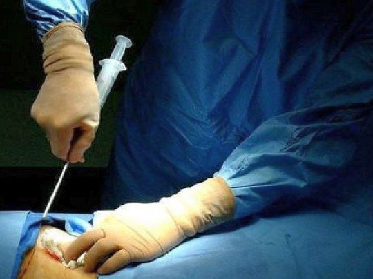 Médula Osea Transplante.jpg