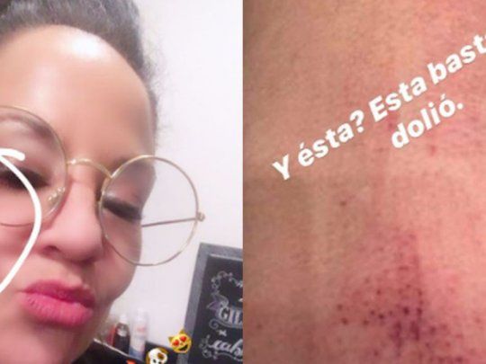 El episodio ahora judicializado tomó estado público entre la noche del domingo y el lunes cuando&nbsp;Miss Bolivia denunció a su ex marido por violencia de género a través de mensajes en sus redes sociales, en los que compartió fotos con heridas en sus extremidades y en la cara.