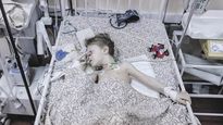 HORROR. Un niño de la ciudad portuaria de Mariúpol está internado luego de sufrir lesiones por un ataque ruso.