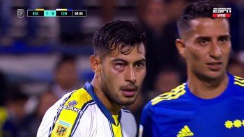 Así quedó el ojo de Emmanuel Ojeda tras el cobarde golpe de Diego González.