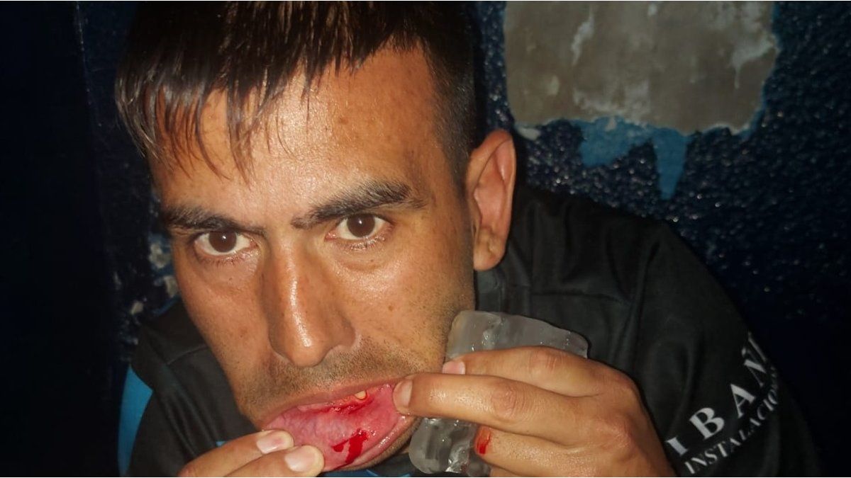 Scandal on promotion: they were ambushed in the stadium tunnel, beaten and everything was stolen