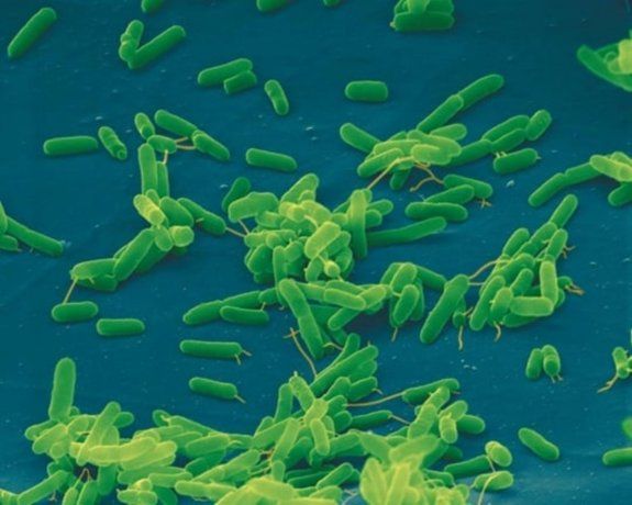 Los investigadores identificaron cómo esta bacteria ancla su membrana protectora a su pared celular mediante una especie de Los investigadores identificaron cómo esta bacteria ancla su membrana protectora a su pared celular mediante una especie de