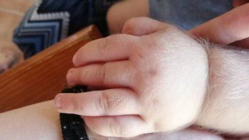 Los afectados son al menos 17 niños