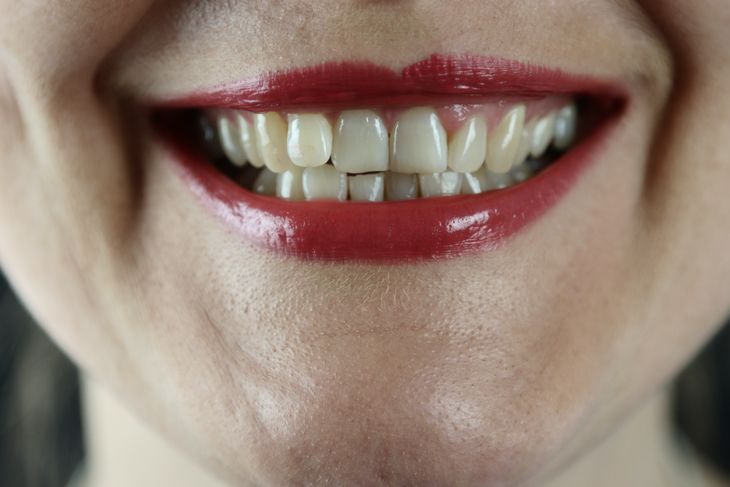 It is important to maintain oral hygiene to avoid the formation of bacteria. It is important to maintain oral hygiene to avoid the formation of bacteria.