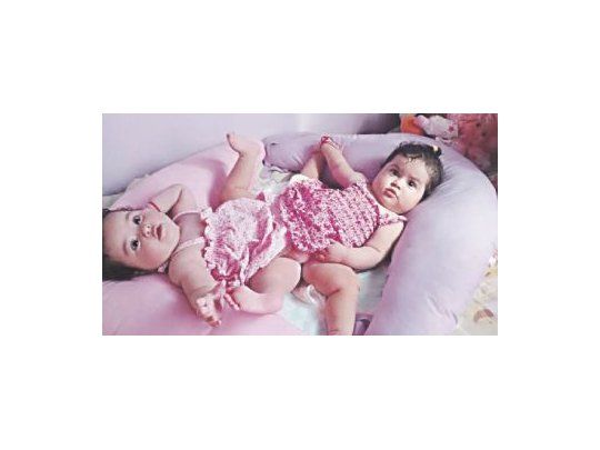 Luciana y Bianca Fernández eran operadas anoche en el Hospital Posadas. Su madre iba relatando cada avance a través de la red social Facebook.