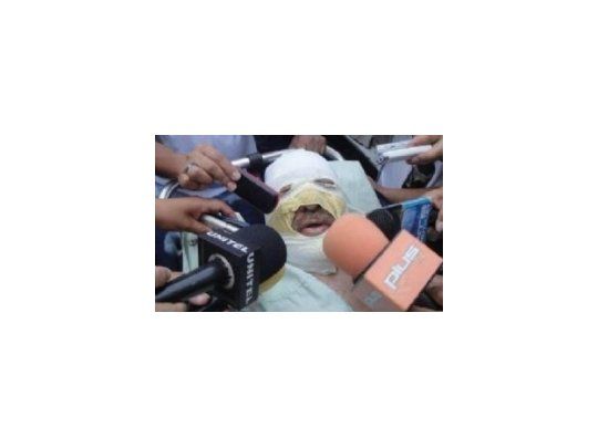 Conmoción en Bolivia: queman a periodista mientras conducía programa de radio
