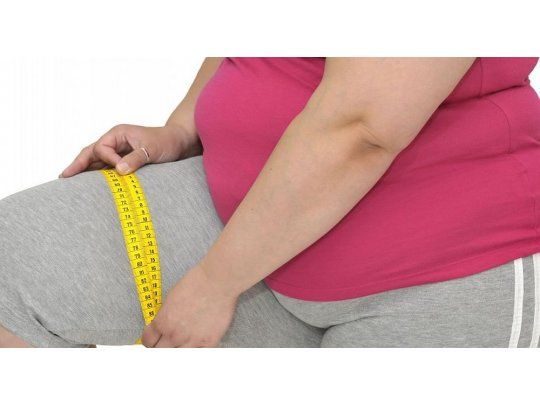Obesidad mórbida: ¿quiénes pueden operarse?