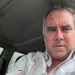 Rafael Belaúnde Llosa fue víctima de una balacera en Perú. Rafael Belaúnde Llosa fue víctima de una balacera en Perú.