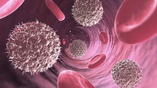 El tratamiento experimental une dos fármacos ya aprobados que refuerzan la respuesta del sistema inmunitario contra el cáncer. El tratamiento experimental une dos fármacos ya aprobados que refuerzan la respuesta del sistema inmunitario contra el cáncer.