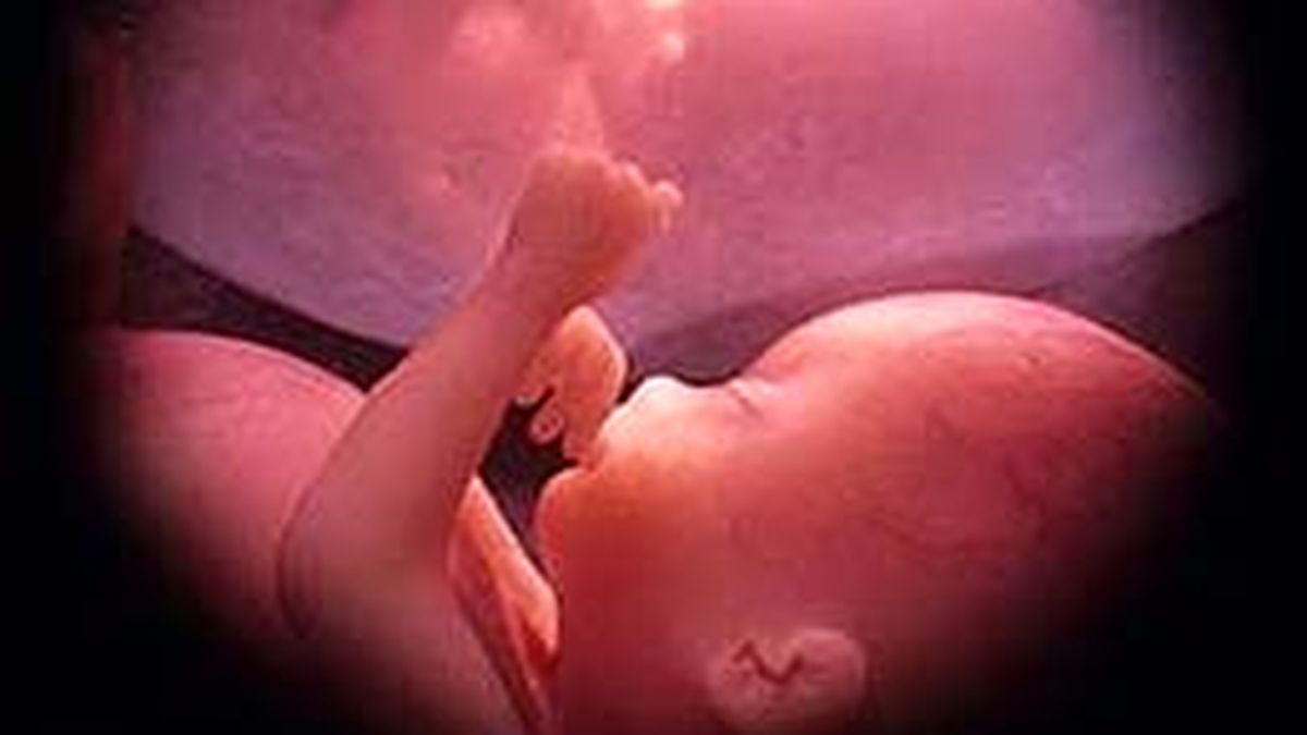 Crean test no invasivo para saber si el feto tiene síndrome de Down