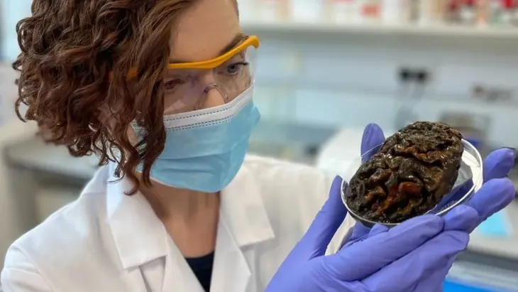 BBC: Alexandra Morton-Hayward, brain preserved for more than 1,000 years. BBC: Alexandra Morton-Hayward, brain preserved for more than 1,000 years.