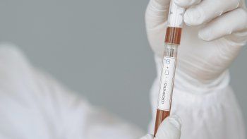 murio voluntario de la vacuna de oxford contra covid-19 en brasil