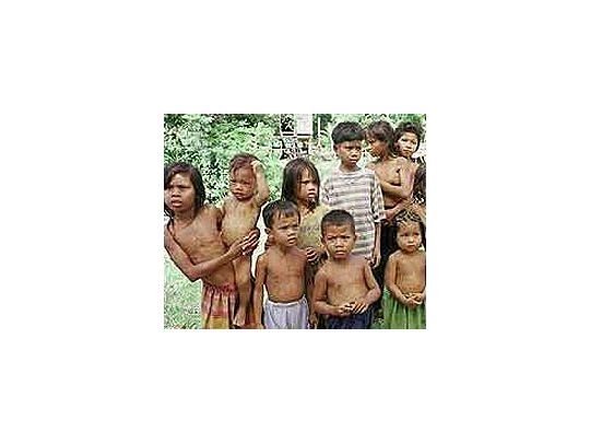 84% de los niños que había tenido problemas de desnutrición en el primer año de vida presenta alteraciones en el sistema lingüístico.