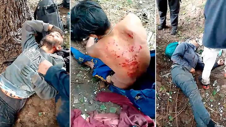 The victims, of 23, 30, 40, 40 and 41, were sheltered under a tree, a ray hit them and were fired. The victims, of 23, 30, 40, 40 and 41, were sheltered under a tree, a ray hit them and were fired.