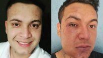El antes y el después de la brutal golpiza que recibió&nbsp;