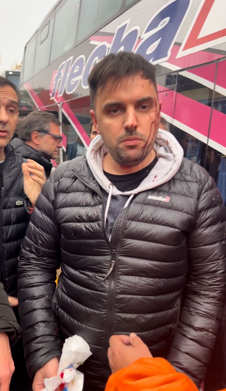 Dos dirigentes resultaron heridos Dos dirigentes resultaron heridos