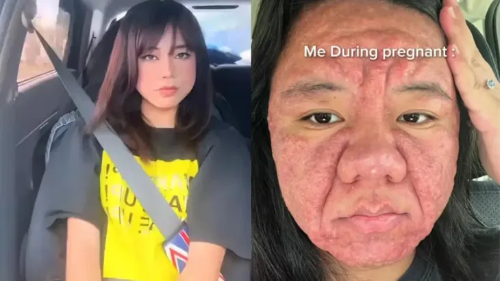 La transformación viral de Farah Faizal durante su embarazo generó millones de reacciones y visibilizó los cambios reales que viven muchas mujeres.  