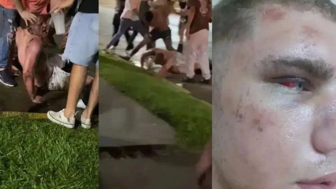 Así quedó el rostro del joven agredido en Córdoba
