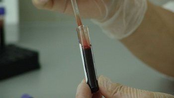 coronavirus: analisis de sangre podria anticipar que pacientes tendran cuadros graves