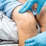 La ANMAT prohibió en todo el país el tornillo traumatológico “SPIN® 2.0” por no contar con registro sanitario. La ANMAT prohibió en todo el país el tornillo traumatológico “SPIN® 2.0” por no contar con registro sanitario.