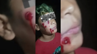 El menor herido es hijo de una de las personas que trabajan en el comedero Es hora de ser felices.