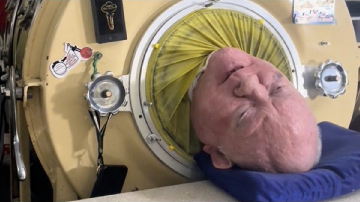 Paul Alexander, the man who lived for 70 years inside an iron lung, has died