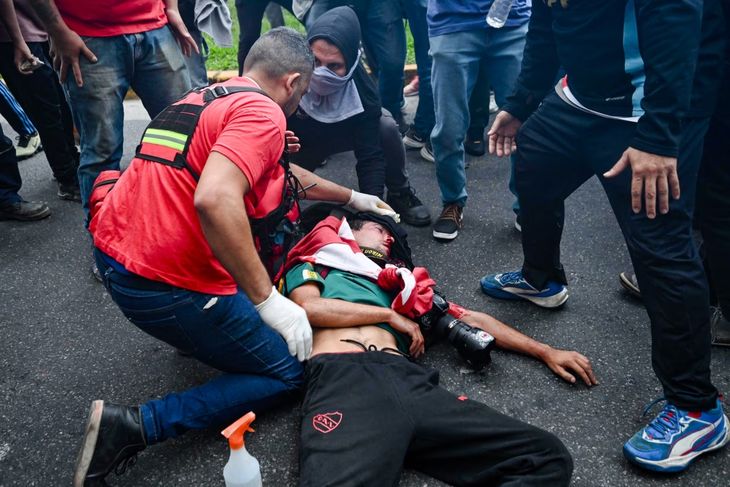Pablo Grillo, fotógrafo de 35 años, fue herido el pasado 12 de marzo, mientras registraba una marcha de jubilados frente al Congreso.
