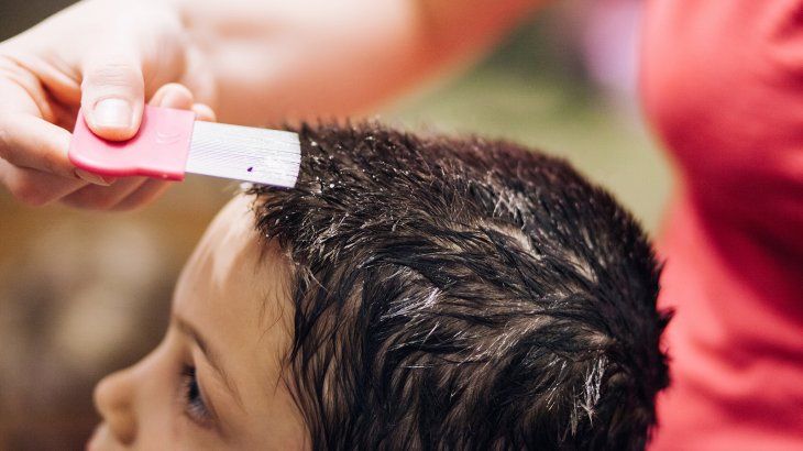 How to prevent lice according to science. 
