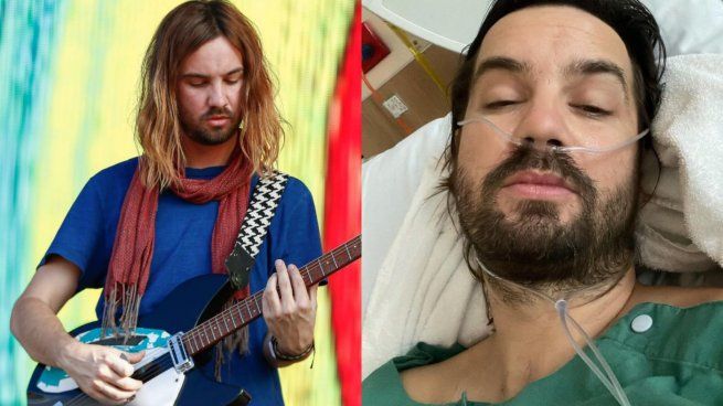 Kevin Parker from Tame Impala broke his hip. What will happen to his show at Lollapalooza?