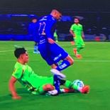 Alan Medina, jugador de Pumas, sufrió una grave lesión durante el partido ante FC Juárez. Tuvo fractura de tobillo izquierdo y será operado Alan Medina, jugador de Pumas, sufrió una grave lesión durante el partido ante FC Juárez. Tuvo fractura de tobillo izquierdo y será operado