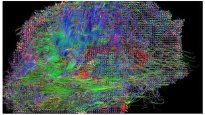 Un grupo de científicos logró elaborar un mapa del cerebro sin precedentes.&nbsp;