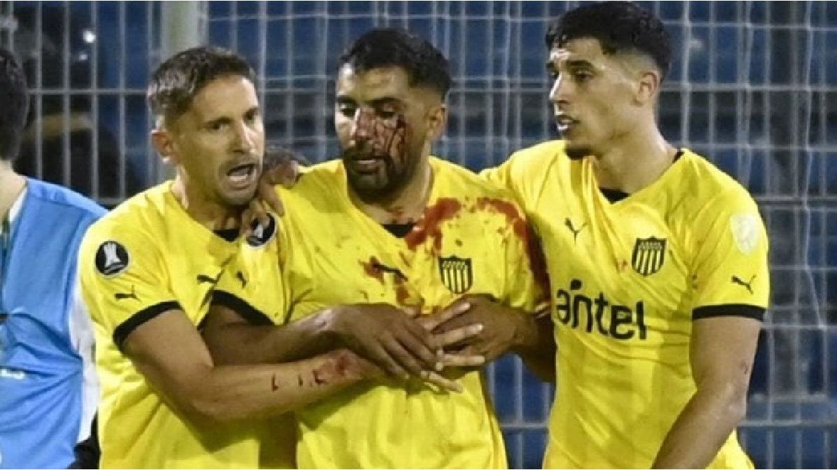 Rosario Central is exposed to a very serious sanction after hitting a Peñarol player with a stone