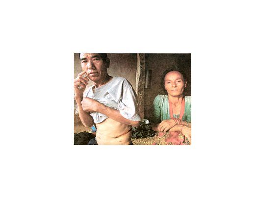 El campesino Indra Bahadur muestra la cicatriz que le quedó de la ablación de riñón a la que se acaba de someter por 600 euros.