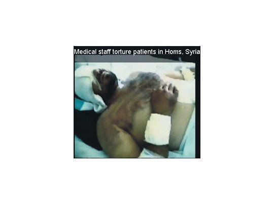 La televisión británica emitió el lunes a la noche un impactante material sobre las torturas aplicadas en los hospitales de Siria por el régimen de Bashar al Asad. Arrecia la represión en ese país.