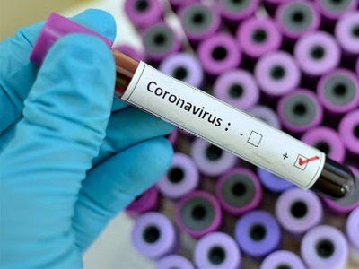 Coronavirus el segundo muerto en la Argentina es un ingeniero de