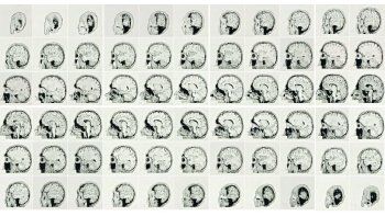 ámbito.com | Leonardo Blanc. “Lápiz sobre papel”, 2017. La obra actual del artista, que sufrió un grave accidente automovilístico que afectó su motricidad, está basada en el cuerpo humano, en especial el cerebro.
