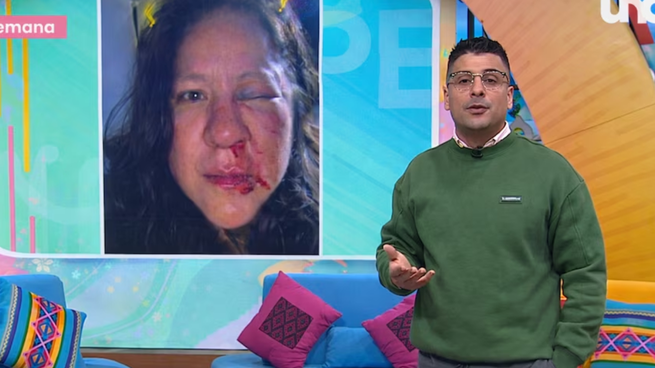 Integrante de Venga la Alegría sufre feroz golpiza.