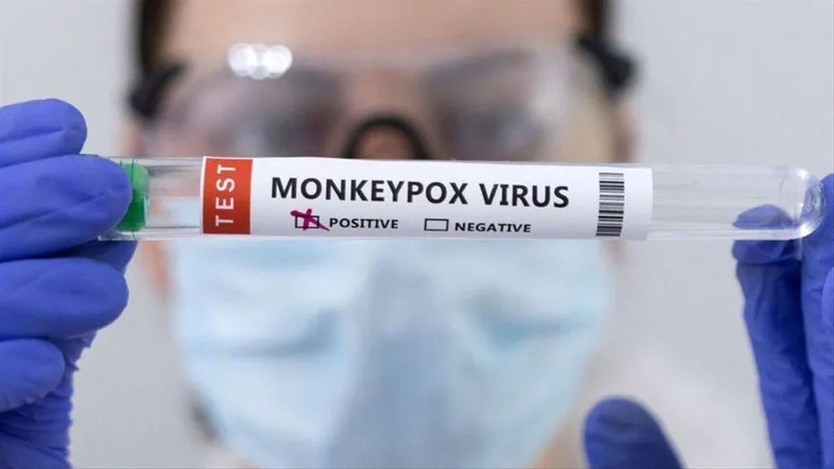 US approves monkeypox test