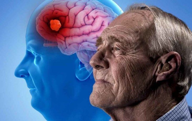 Es una enfermedad progresiva, en la que los síntomas de demencia empeoran gradualmente con el paso de los años. Es una enfermedad progresiva, en la que los síntomas de demencia empeoran gradualmente con el paso de los años.