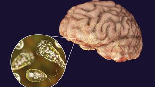 Ameba come-cerebros: qué es y cómo se contrae la infección. Ameba come-cerebros: qué es y cómo se contrae la infección.