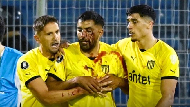 El lateral de peñarol Maximiliano Olivera fue agredido y resultó herido en su pómulo durante el partido entre Rosario Central y Peñaol.