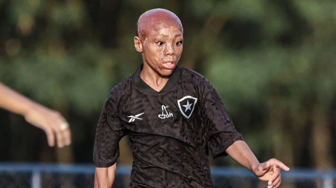 El juvenil del Botafogo emocionó a todos con su historia y da sus primeros pasos en el fútbol.