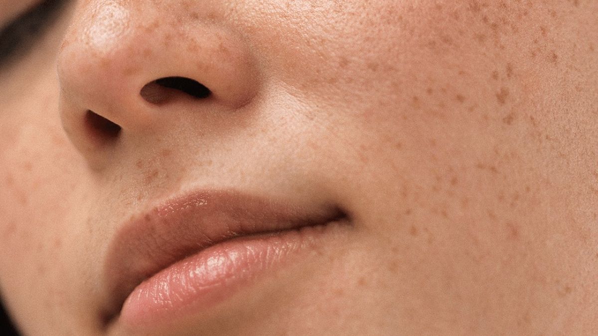 the infallible trick to remove spots on the skin