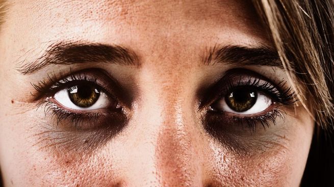 El mejor truco para eliminar las ojeras
